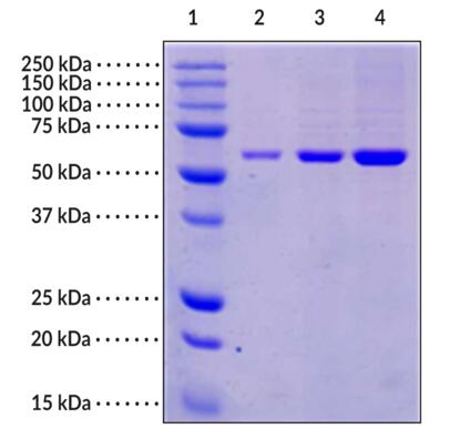 Lane 1: MW Markers<br />Lane 2: PTEN (2 μg)<br />Lane 3: PTEN (5 μg)<br />Lane 4: PTEN (10 μg)